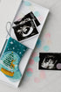 Let It Snow stocking displayed beside ultrasound photo for a sentimental holiday reveal